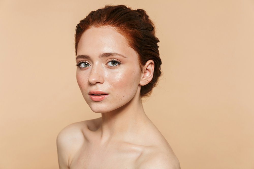 Rolling Acne Scars: Causes, Skin Tethering, and Treatment Options